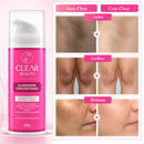 Clareador de Virilha e Axila Creme Clareador Partes Intimas - Clear Beauty Original